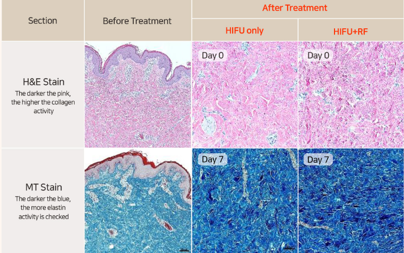 elastin activation